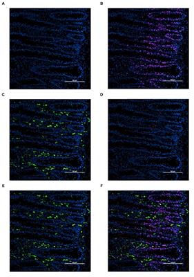 Combined Maternal and Post-Hatch Dietary Supplementation of 25-Hydroxycholecalciferol Alters Early Post-Hatch Broiler Chicken Duodenal Macrophage and Crypt Cell Populations and Their Mitotic Activity